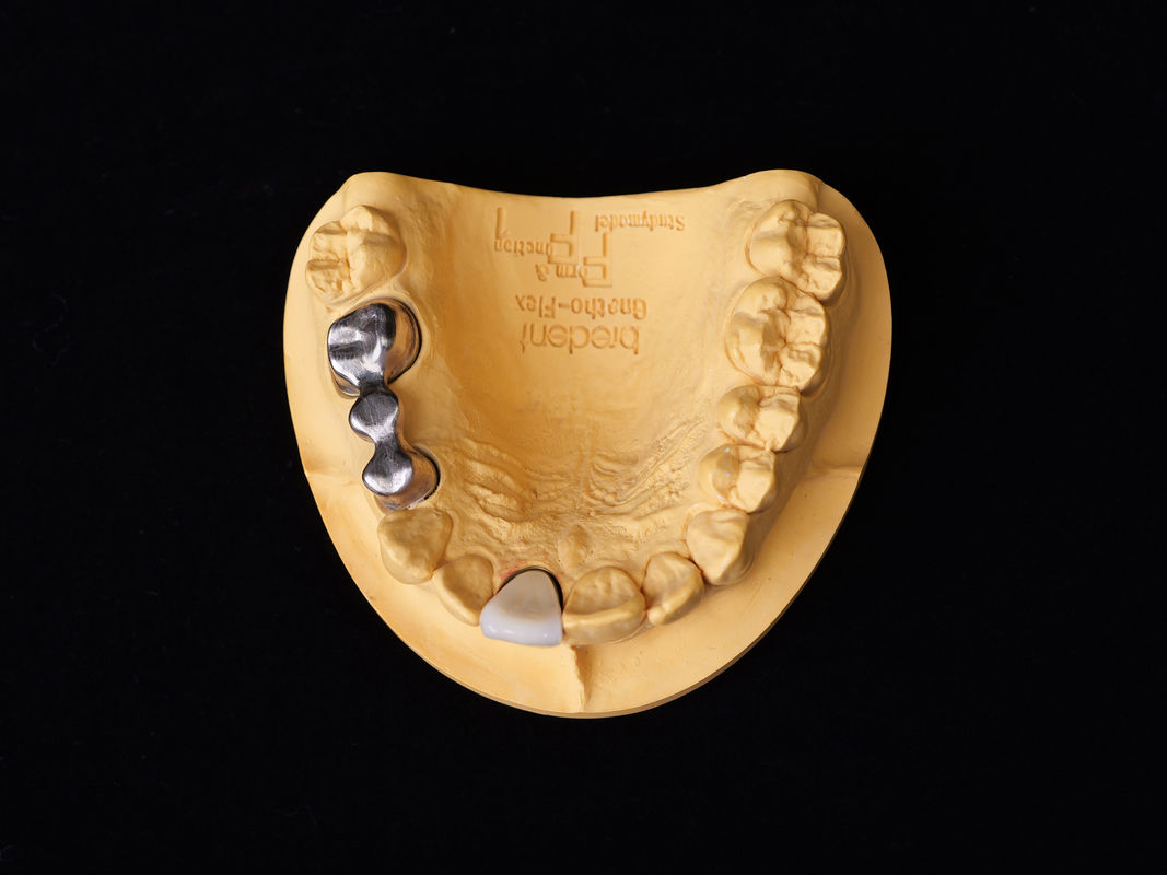 Audental 04 ノーブル合金 シルバー・パラジウム ポルセラン合金 ホワイト Pd53.3% 長持ち歯修復用