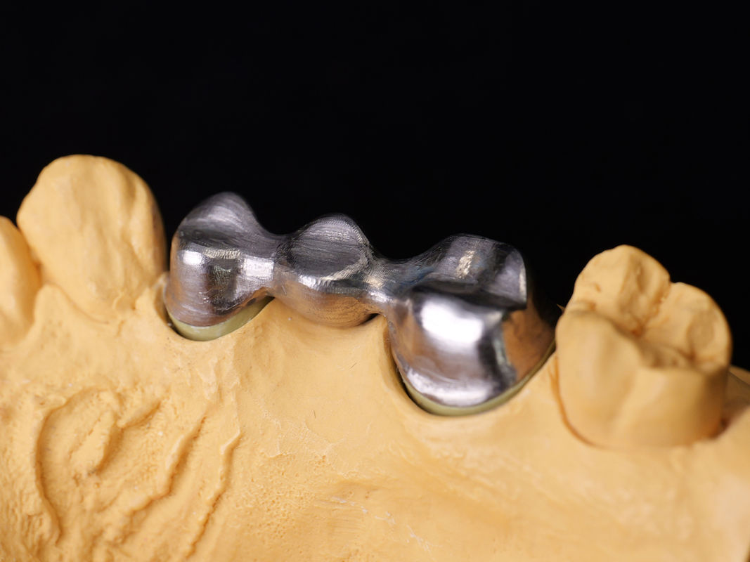 Audental 04 ノーブル合金 シルバー・パラジウム ポルセラン合金 ホワイト Pd53.3% 長持ち歯修復用