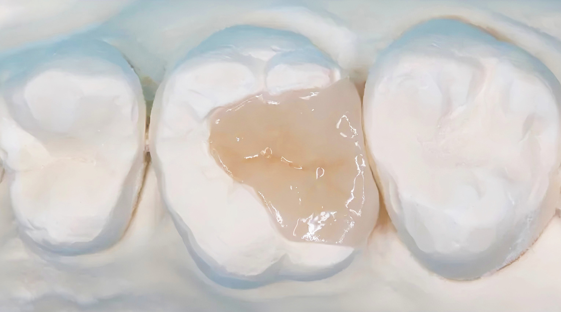 Superior Flexural Strength and Natural Optical Properties in Dental Glass Ceramics from Audental